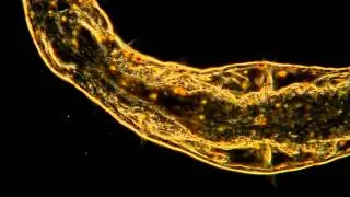 Amazing Microscopic Worm Magnified 400 Times!