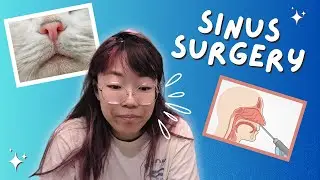 Getting sinus surgery while awake??