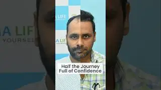 Best Hair Transplant Clinic in Delhi | Before After Best Results | Cost of Hair Transplant in Delhi