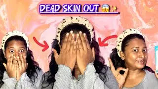 DEAD SKIN OUT 😱✨// INSTANT GLOW ✨//This Peel Changed My Skin🥰