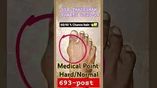 SSB TRADESMAN BHARTI 2023-24 |MEDICAL POINT HARD/NORMAL 👈🇮🇳#constable #ssb #tradesmen #indian #bsf