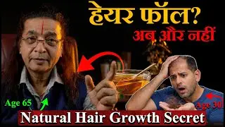 बिना दवा Hair Fall रोकें | DHT कम करने की Exercise & Superfood