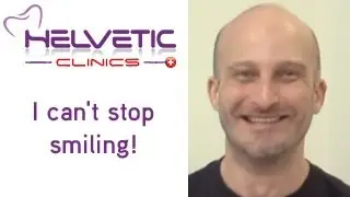 16 Crowns and veneers - Helvetic Dental Clinics Abroad