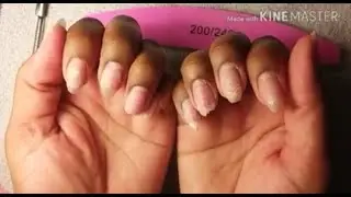 ♡~How I Manage My Damaged Nails~♡