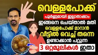 വെള്ളപോക്ക് പൂർണ്ണമായി ഇല്ലാതാക്കാം ഇങ്ങനെ ചെയ്‌താൽ മതി Dr Muhsin