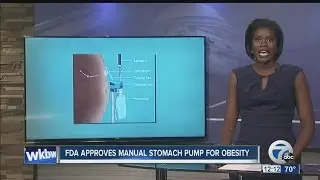 More harm than good? New device allows users to empty stomach contents