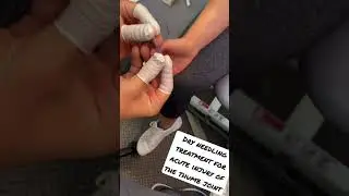 Sports medicine dry needling twitch response &mdash; pain management #shorts