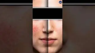 STOP! These Daily Habits Are Secretly Ruining Your Skin! 😱🔥#healthnow #health #skincare