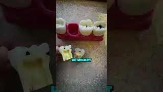 Маленькое пятно &mdash; беда 😬