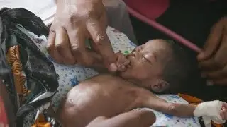 The UCSF East Africa Preterm Birth Initiative