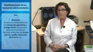 Trastornos del movimiento