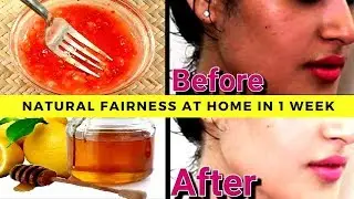 How to Get Fair Skin at Home In 1 Week : Natural Skin Whitening | Fairness Tips |