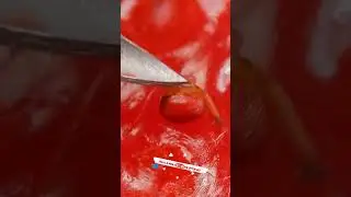 zoom microscope camera#yt #videos