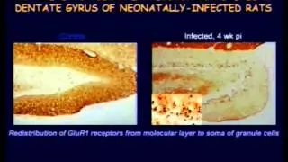 Immunity & redux: infectious and immunotoxic factors in autism - Mady Hornig, MA, MD