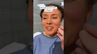Natural Results| Reset Facelift 6 Month Post-Op| Before and After