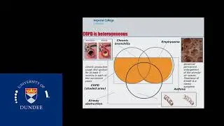 Grand Rounds 2nd June 2016 - Jenni Quint, Imperial College, COPD and MI: A dangerous Liaison