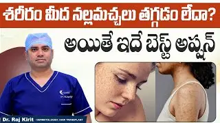 Body Pigmentation Treatment | Skin Pigmentation Causes | Best Treatment for Pigmentation | Celestee