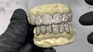 Top 6 & Bottom 6 VS+ Diamond Grillz on White Gold | Luxe Grillz