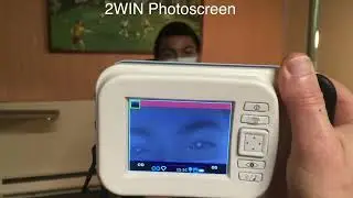 Multifaceted Amblyopia screening with blinq, 2WIN and PDI Check - Video abstract [ID 349638]