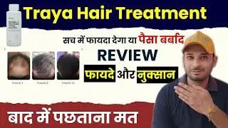Traya Review - सच में फायदा देगा Ya पैसा बर्बाद | Traya hair treatment my honest review