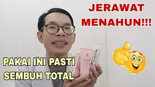 Solutions for Chronic Acne That Won't Heal!!!