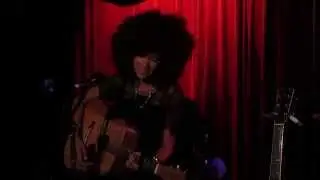 Andy Allo: 