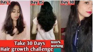 30 Days Hair Growth Challenge | Regrowth & Real Results | Akshita Diaries #hairgrowth#hairfallremedy