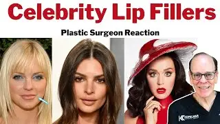 Celebrities Getting Lip Fillers | Plastic Surgeon Reacts