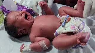 How to Help Baby Walk Early Naturally 👶🚶&zwj;♂️ | Oil Massage 💆&zwj;♀️ & Physiotherapy Exercises