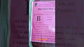 What is PRBC Blood also known as packed red blood cells (prbc)