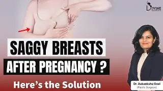 Saggy Breasts After Breastfeeding? Here&rsquo;s How Breast Lift Surgery Helps