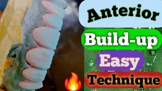 Anterior Ceramic Porcelain| Anterior ceramic build up| Ceramic Layering video| dental technician|lab