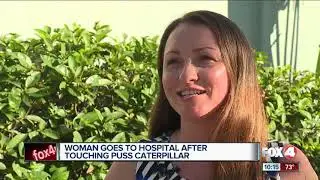 Cape Coral woman gets bit by a puss caterpillar at local dog park.