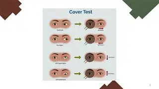 BV Cover test & Prism Cover Test 