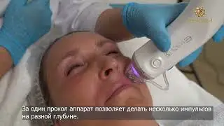 Презентация нового аппарата ELLISYS SENSE. Рассказывает Алексей Костенко