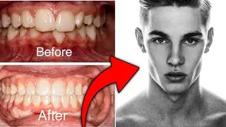 Your Face Looks Worse Because of Your Teeth (Here&rsquo;s Why)