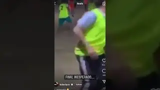 He broke his arm after playing football 🤣￼