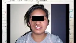 Syndromes | Part 1 | Oral pathology lectures