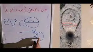 جرن القفل ( جرن الدلو)