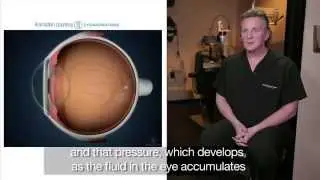 Glaucoma - The Silent Thief of Vision