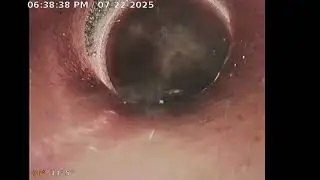 Root Intrusion