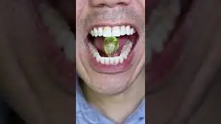 ASMR | Diamond Hard Candy #DoctorTristanPeh #ASMR
