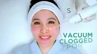 Sandra Dewi Silkpeel Blink Beauty Clinic Jakarta