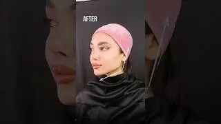 Hollywood face #recommended #рек #top #beauty #aesthetic #lifting #lips #botox #skincare #fullface