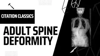 Spine Citation Classics: 05 Adult Spine Deformity