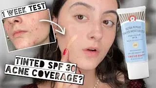 TESTING FIRST AID BEAUTY ULTRA REPAIR TINTED MOISTURIZER SPF 30 On ACNE for 1 Week | Acne Coverage?