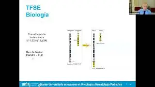 Sarcoma de Ewing - Tumores Solidos 2 (211025)