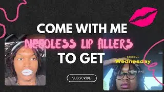 Needless Lip Filler Vlog💋