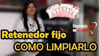 RETENEDOR FIJO | Como limpiarlo - Odontología Láser