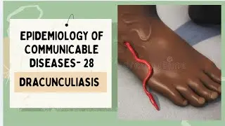 メジナ虫症